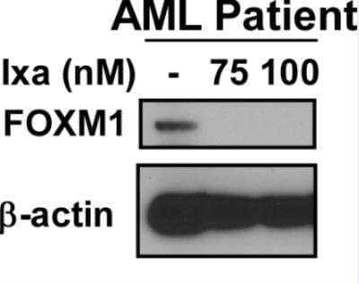 Western Blot FoxM1 Antibody