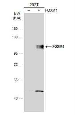 Western Blot: FoxM1 Antibody [NBP2-16519] - Non-transfected (-) and transfected (+) 293T whole cell extracts (30 ug) were separated by 7.5% SDS-PAGE, and the membrane was blotted with FOXM1 antibody diluted at 1:5000. The HRP-conjugated anti-rabbit IgG antibody (NBP2-19301) was used to detect the primary antibody.