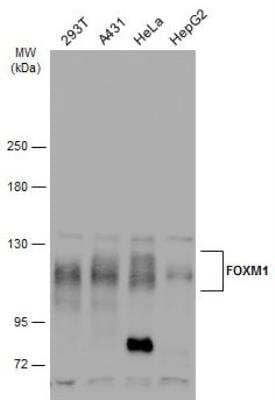 Western Blot: FoxM1 Antibody [NBP2-16519] - Various whole cell extracts (30 ug) were separated by 5% SDS-PAGE, and the membrane was blotted with FOXM1 antibody diluted at 1:500. The HRP-conjugated anti-rabbit IgG antibody (NBP2-19301) was used to detect the primary antibody.