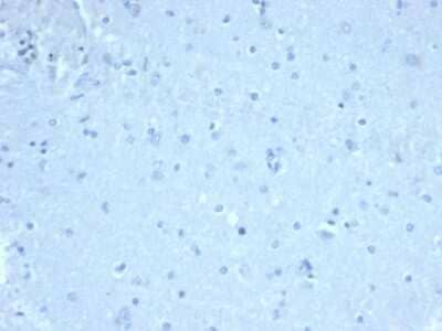 Immunohistochemistry-Paraffin: FoxP1 Antibody (FOXP1/44R) - Azide and BSA Free [NBP3-08470] - IHC analysis of formalin-fixed, paraffin-embedded human brain. Negative tissue control. FoxP1 antibody (FOXP1/44R) at 1ug/ml in PBS for 30min RT. HIER: Tris/EDTA, pH9.0, 45min. 2 : HRP-polymer, 30min. DAB, 5min.