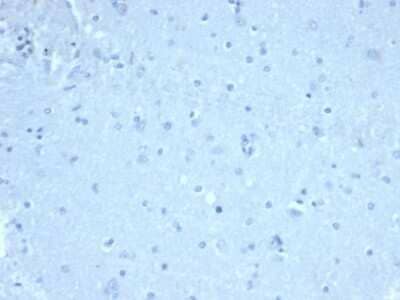 Immunohistochemistry-Paraffin: FoxP1 Antibody (FOXP1/44R) [NBP3-07297] - IHC analysis of formalin-fixed, paraffin-embedded human brain. Negative tissue control. FoxP1 antibody (FOXP1/44R) at 1ug/ml in PBS for 30min RT. HIER: Tris/EDTA, pH9.0, 45min. 2 : HRP-polymer, 30min. DAB, 5min.