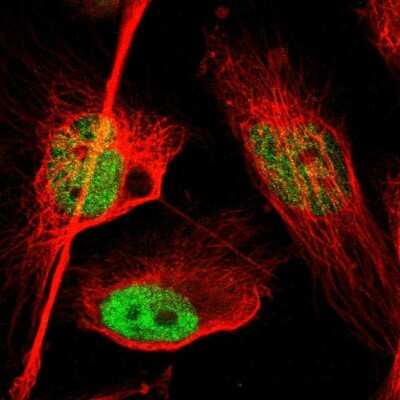 <b>Genetic Strategies Validation. </b>Immunocytochemistry/Immunofluorescence: FoxP1 Antibody [NBP1-89410] - Saining of human cell line U-251 MG shows localization to nucleoplasm. Antibody staining is shown in green.