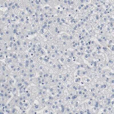 Immunohistochemistry-Paraffin: FoxP1 Antibody [NBP1-89410] - Staining of human liver shows no positivity in hepatocytes as expected.