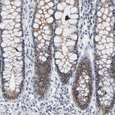 Immunohistochemistry-Paraffin: FoxP1 Antibody [NBP1-89410] - Staining of human rectum shows moderate nuclear positivity in glandular cells.