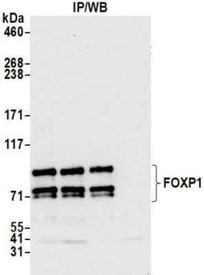 Immunoprecipitation: FoxP1 Antibody [NBP3-14715] - Whole cell lysate (1.0 mgper IP reaction; 20% of IP loaded) from HeLa cells preparedusing NETN lysis buffer. Antibodies: Rabbit anti-FOXP1recombinant monoclonal antibody used for IP at 20 ul/mg lysate. FOXP1 was alsoimmunoprecipitated by anti-FOXP1 antibodies. For blottingimmunoprecipitated FOXP1, was used at1:1000. Chemiluminescence with an exposure time of 10 