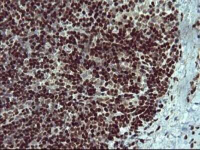 Immunohistochemistry: FoxP1 Antibody (OTI4F1) - Azide and BSA Free [NBP2-71831] - Analysis of Human lymph node tissue.