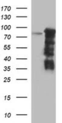 Western Blot: FoxP1 Antibody (OTI4F1) - Azide and BSA Free [NBP2-71831] - Analysis of HEK293T cells were transfected with the pCMV6-ENTRY control (Left lane) or pCMV6-ENTRY FoxP1.