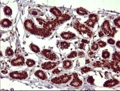 Immunohistochemistry: FoxP1 Antibody (OTI4F1) [NBP2-45713] - Analysis of Human breast tissue.