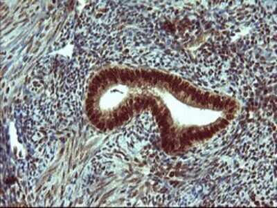 Immunohistochemistry: FoxP1 Antibody (OTI4F1) [NBP2-45713] - Analysis of Human endometrium tissue.