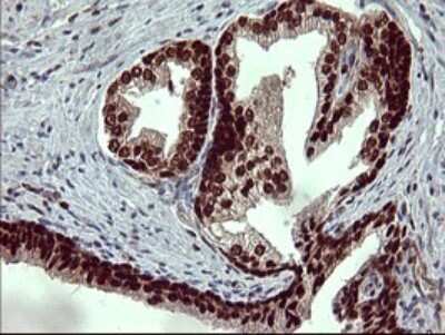 Immunohistochemistry: FoxP1 Antibody (OTI4F1) [NBP2-45713] - Analysis of Human prostate tissue.