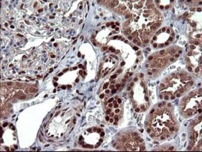 Immunohistochemistry: FoxP1 Antibody (OTI4F1) [NBP2-45713] - Analysis of Human Kidney tissue.