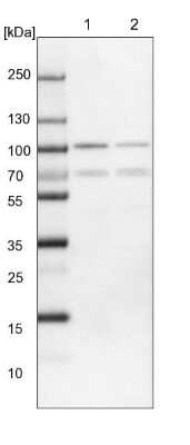 Western Blot: FoxP1 Antibody [NBP1-89410] - Lane 1: NIH-3T3 cell lysate (Mouse embryonic fibroblast cells). Lane 2: NBT-II cell lysate (Rat Wistar bladder tumor cells).