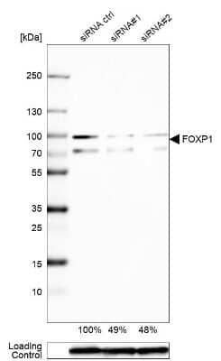 Western Blot: FoxP1 Antibody [NBP1-89410] - Analysis in Caco-2 cells transfected with control siRNA, target specific siRNA probe #1 and #2,. Remaining relative intensity is presented. Loading control: Anti-GAPDH.