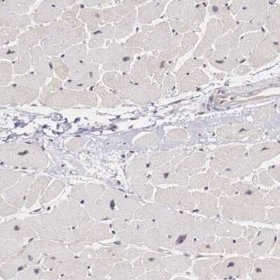 Immunohistochemistry-Paraffin: FoxP2 Antibody [NBP1-86672] - Staining of human heart muscle shows low expression as expected.