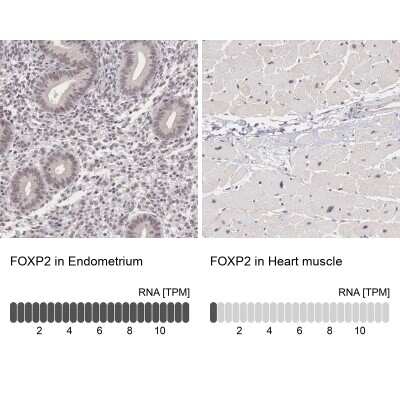 Immunohistochemistry-Paraffin: FoxP2 Antibody [NBP1-86672] - Staining in human endometrium and heart muscle tissues using anti-FOXP2 antibody. Corresponding FOXP2 RNA-seq data are presented for the same tissues.