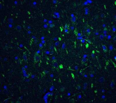 Immunocytochemistry/Immunofluorescence: FoxP3 Antibody [NBP2-41205] - Human brain tissue with FOXP3 antibody at 20 ug/mL.