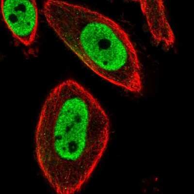 Immunocytochemistry/Immunofluorescence: FoxP3 Antibody [NBP2-58697] - Staining of human cell line PC-3 shows localization to nucleoplasm. Antibody staining is shown in green.