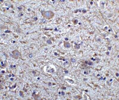 Immunohistochemistry-Paraffin: FoxP3 Antibody [NBP2-41205] - Human brain tissue with FOXP3 antibody at 5 ug/mL.