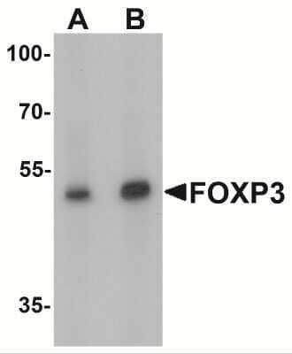 Western Blot: FoxP3 Antibody [NBP2-41205] - Western blot analysis of FOXP3 in A549 cell lysate with FOXP3 antibody at (A) 1 and (B) 2 ug/mL.