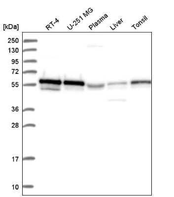 Western Blot: FoxP3 Antibody [NBP2-58697] - Western blot analysis in human cell line RT-4, human cell line U-251 MG, human plasma, human liver tissue and human tonsil tissue.