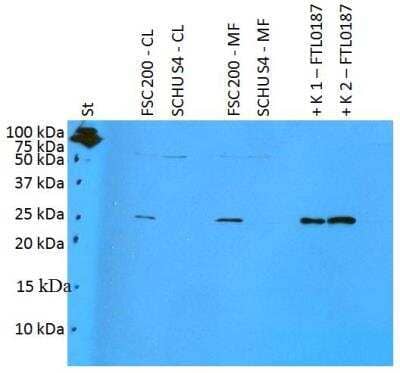 Western Blot: Francisella tularensis ssp. holarctica antigen FTL0187 Antibody [NBP2-62185] - Analysis of polyclonal anti-Francisella tularensis subsp. holarctica antigen FTL0187. St: Mw marker FSC200-CL: 10 ug of F. tularensis ssp. holarctica FSC200 cell lysateSCHUS4-CL: 10 ug of F. tularensis ssp. tularensis SCHU S4 cell lysateFSC200-MF: 10 ug of F. tularensis ssp. holarctica FSC200 membrane fractionSCHUS4-CL: 10 ug of F. tularensis ssp. tularensis SCHU S4 membrane fraction K1: 50 ng of FTL0187 recombinant proteinK2: 125 ng of FTL0187 recombinant protein