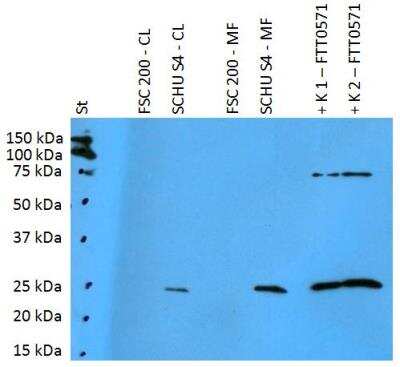 Western Blot: Francisella tularensis ssp. tularensis antigen FTT0571 Antibody [NBP2-62179] - Analysis of polyclonal anti-Francisella tularensis subsp. tularensis antigen FTT0571. St: Mw marker FSC200-CL: 10 ug of F. tularensis ssp. holarctica FSC200 cell lysateSCHUS4-CL: 10 ug of F. tularensis ssp. tularensis SCHU S4 cell lysateFSC200-MF: 10 ug of F. tularensis ssp. holarctica FSC200 membrane fractionSCHUS4-CL: 10 ug of F. tularensis ssp. tularensis SCHU S4 membrane fraction K1: 50 ng of FTT0571 recombinant proteinK2: 125 ng of FTT0571 recombinant protein