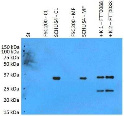 Western Blot: Francisella tularensis ssp. tularensis antigen PilT Antibody [NBP2-62178] - Analysis of polyclonal anti-Francisella tularensis subsp. tularensis antigen FTT0088. St: Mw marker FSC200-CL: 10 ug of F. tularensis ssp. holarctica FSC200 cell lysateSCHUS4-CL: 10 ug of F. tularensis ssp. tularensis SCHU S4 cell lysateFSC200-MF: 10 ug of F. tularensis ssp. holarctica FSC200 membrane fractionSCHUS4-CL: 10 ug of F. tularensis ssp. tularensis SCHU S4 membrane fraction K1: 50 ng of FTT0088 recombinant proteinK2: 125 ng of FTT0088 recombinant protein