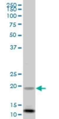Western Blot: Frataxin Antibody [H00002395-B01P] - Analysis of FXN expression in human liver.