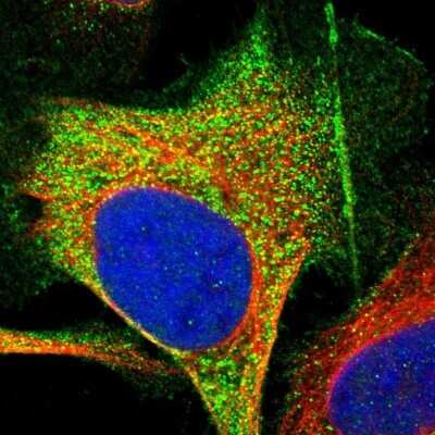 Immunocytochemistry/Immunofluorescence: Frequenin Antibody [NBP1-89820] - Staining of human cell line U-2 OS shows localization to plasma membrane and vesicles.