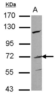 Western Blot: Frizzled-1 Antibody [NBP2-16530] - Sample (30 ug of whole cell lysate) A: Raji 7. 5% SDS PAGE gel, diluted at 1:500.