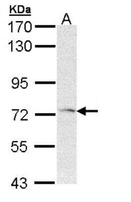 Western Blot: Frizzled-1 Antibody [NBP2-16531] - Sample (30 ug of whole cell lysate) A: Hep G2 7. 5% SDS PAGE gel, diluted at 1:1000.