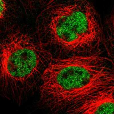 Immunocytochemistry/Immunofluorescence: Frizzled-10 Antibody [NBP1-85753] - Immunofluorescent staining of human cell line A-431 shows localization to nucleoplasm. Antibody staining is shown in green. 