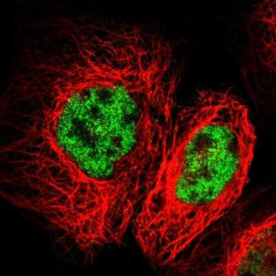 Immunocytochemistry/Immunofluorescence: Frizzled-10 Antibody [NBP1-85754] - Immunofluorescent staining of human cell line A-431 shows localization to nucleoplasm. Antibody staining is shown in green. 