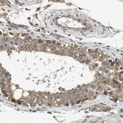 Immunohistochemistry-Paraffin: Frizzled-10 Antibody [NBP1-85753] - Staining of human testis shows strong cytoplasmic positivity in a subset of cells in seminiferus ducts.