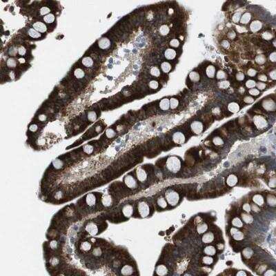 Immunohistochemistry-Paraffin: Frizzled-10 Antibody [NBP1-85754] - Staining of human colon shows strong cytoplasmic positivity in glandular cells.