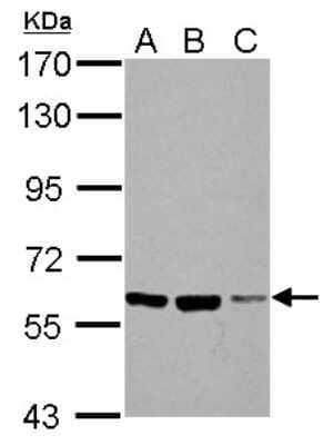 Western Blot: Frizzled-10 Antibody [NBP2-16532] - Sample (30 ug of whole cell lysate) A: NIH-3T3 B: JC C: BCL-1 7. 5% SDS PAGE gel, diluted at 1:1000.