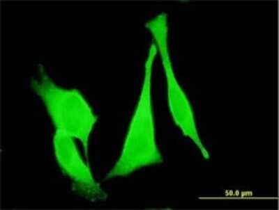 Immunocytochemistry/Immunofluorescence: Frizzled-3 Antibody (2H5) [H00007976-M09] - Analysis of monoclonal antibody to FZD3 on HeLa cell. Antibody concentration 10 ug/ml