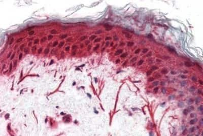 Immunohistochemistry-Paraffin: Frizzled-3 Antibody [NBP3-14325] - Immunohistochemistry of formalin-fixed, paraffin-embedded human skin after heat-induced antigen retrieval.