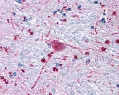 Immunohistochemistry-Paraffin: Frizzled-3 Antibody [NLS4437] - Analysis of anti-FZD3 / Frizzled 3 antibody with human brain, neurons and glia.