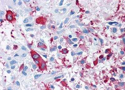 Immunohistochemistry-Paraffin Frizzled-3 Antibody - BSA Free