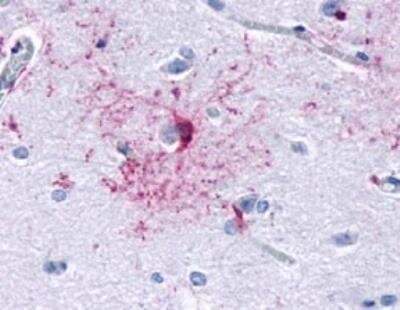 Immunohistochemistry-Paraffin: Frizzled-3 Antibody [NLS4454] - Analysis of anti-FZD3 / Frizzled 3 antibody with brain, neurons and glia at 11 ug/ ml.