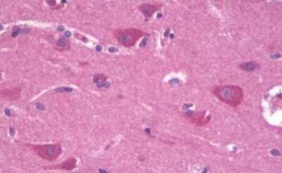 Immunohistochemistry-Paraffin: Frizzled-3 Antibody [NLS4454] - Human Brain, Cortex: Formalin-Fixed, Paraffin-Embedded (FFPE)