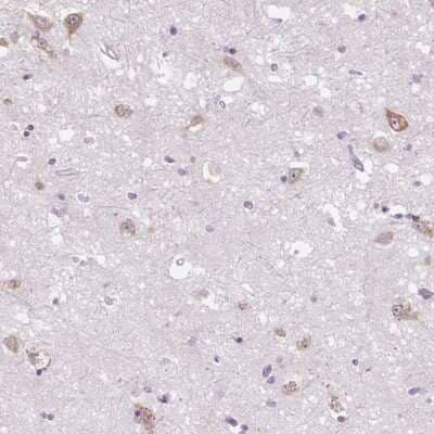 Immunohistochemistry-Paraffin: Frizzled-5 Antibody [NBP2-49040] - Staining of human lateral ventricle shows moderate positivity in neurons.