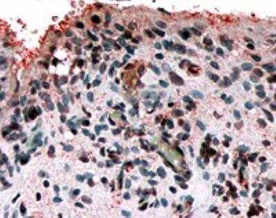 Immunohistochemistry-Paraffin: Frizzled-5 Antibody [NLS4284] - Analysis of anti-FZD5 / Frizzled 5 antibody with Synovium, Rheumatoid Arthritis at 24 ug/ml.