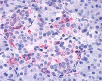 Immunohistochemistry-Paraffin: Frizzled-5 Antibody [NLS4284] - Analysis of anti-FZD5 / Frizzled 5 antibody with pancreas, Islets of Langerhans.
