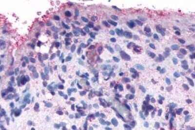 Immunohistochemistry-Paraffin: Frizzled-5 Antibody [NLS4284] - Anti-FZD5 / Frizzled 5 antibody IHC of human synovium, rheumatoid arthritis. Immunohistochemistry of formalin-fixed, paraffin-embedded tissue after heat-induced antigen retrieval.