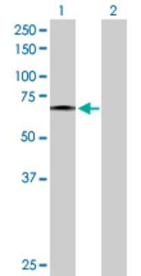 Western Blot: Frizzled-5 Antibody [H00007855-D01P] - Analysis of FZD5 expression in transfected 293T cell line by FZD5 polyclonal antibody.Lane 1: FZD5 transfected lysate(64.50 KDa).Lane 2: Non-transfected lysate.