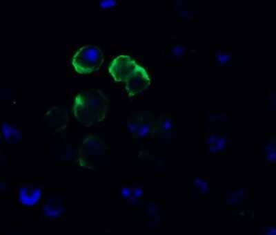 Immunocytochemistry/Immunofluorescence: Frizzled-6 Antibody [NBP3-18335] - Immunofluorescent analysis of 4% paraformaldehyde-fixed Daudi cells labeling Frizzled-6 with NBP3-18335 at 10 ug/mL, followed by goat anti-rabbit IgG secondary antibody at 1/500 dilution (green) and DAPI staining (blue).