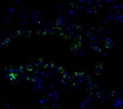 Immunocytochemistry/Immunofluorescence: Frizzled-6 Antibody [NBP3-18335] - Immunofluorescent analysis of 4% paraformaldehyde-fixed mouse lung labeling Frizzled-6 with NBP3-18335 at 10 ug/mL, followed by goat anti-rabbit IgG secondary antibody at 1/500 dilution (green) and DAPI staining (blue).