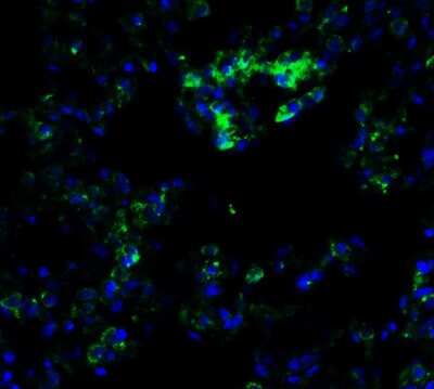 Immunocytochemistry/Immunofluorescence: Frizzled-6 Antibody [NBP3-18335] - Immunofluorescent analysis of 4% paraformaldehyde-fixed rat lung labeling Frizzled-6 with NBP3-18335 at 10 ug/mL, followed by goat anti-rabbit IgG secondary antibody at 1/500 dilution (green) and DAPI staining (blue).